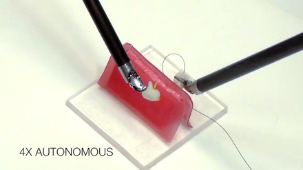 Autonomous Surgical Suturing