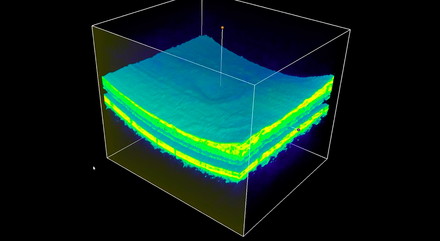 A major milestone for the treatment of eye disease